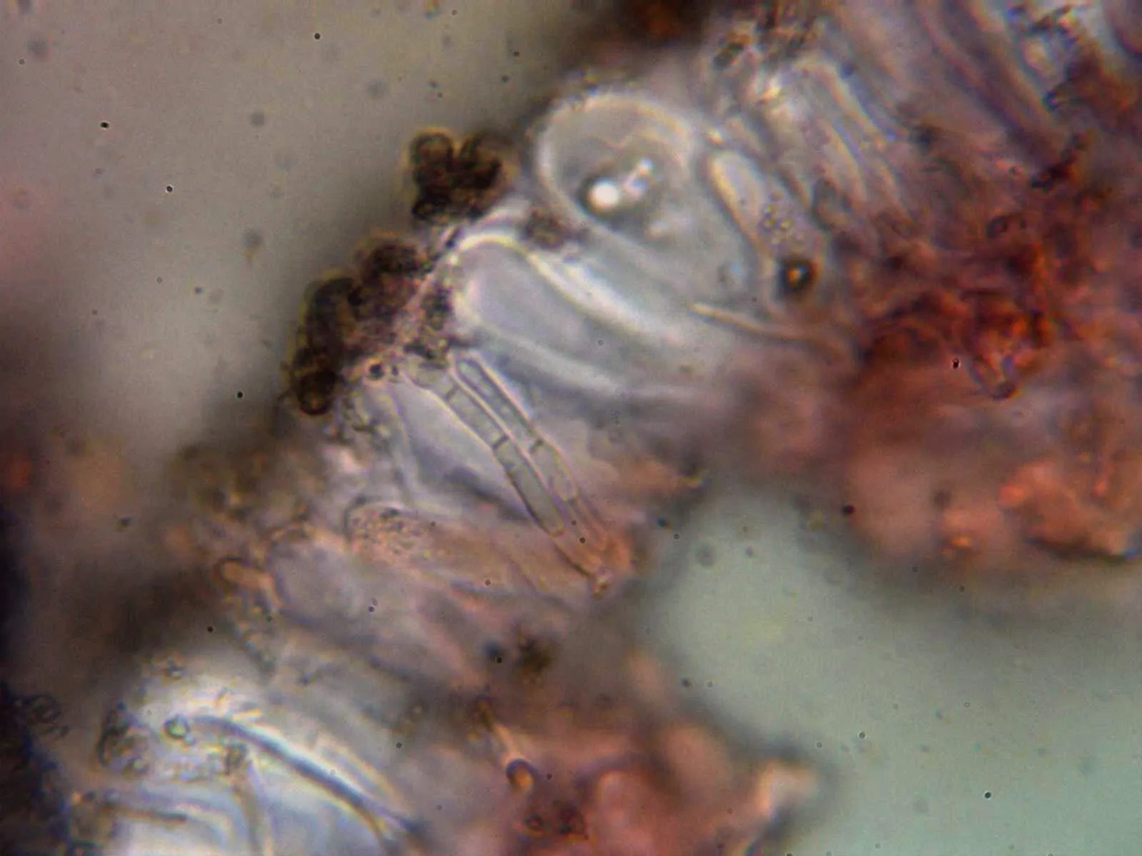 Microscopía de Ramalina sinensis - 10 - Paráfisis